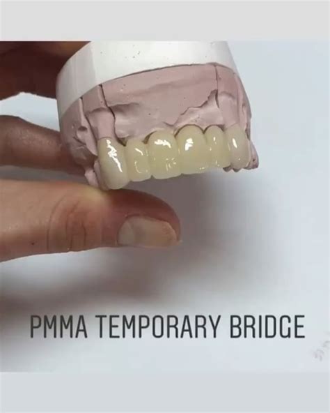 pmma dental pdf